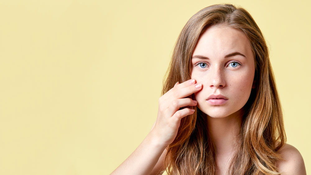 Actualment esteu veient Com afecta l’acne a la teva vida?