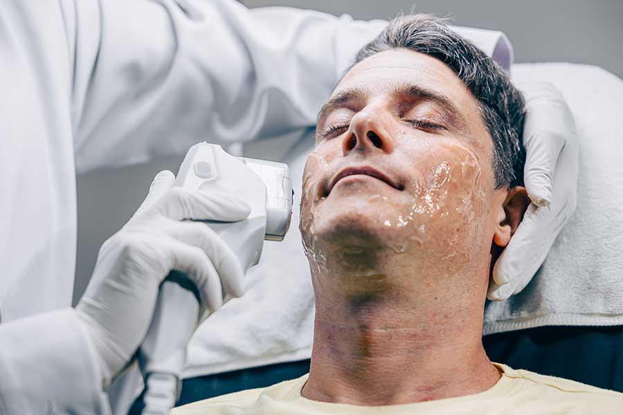 HIFU. Rejuvenecimiento facial para hombres.