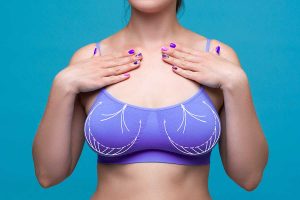 Més informació sobre l'article Reducció mamària: troba alleujament i confiança en el teu cos