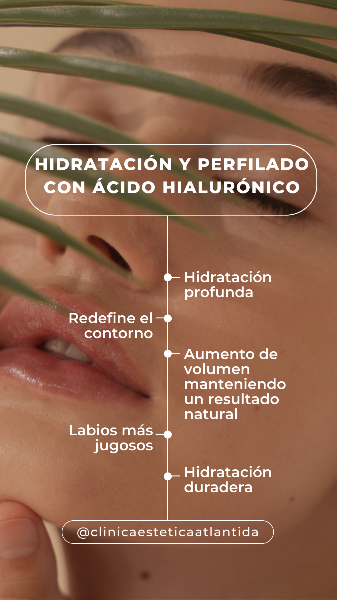 Ácido hialurónico labios para hidratación, perfilado y aumento natural.